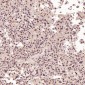 Anti-ACE2 Rabbit Monoclonal Antibody